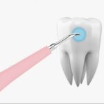 Portable Electric Sonic Dental Scaler Tooth Calculus Remover Tooth Stains Tartar Tool Dentist Whiten Teeth Health Oral Hygiene - Image 4